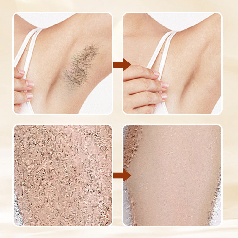 🔥Buy Get 1 Free! 🔥 Introducing Our Versatile, Aromatic, Mild Formula Hair Removal Cream!
